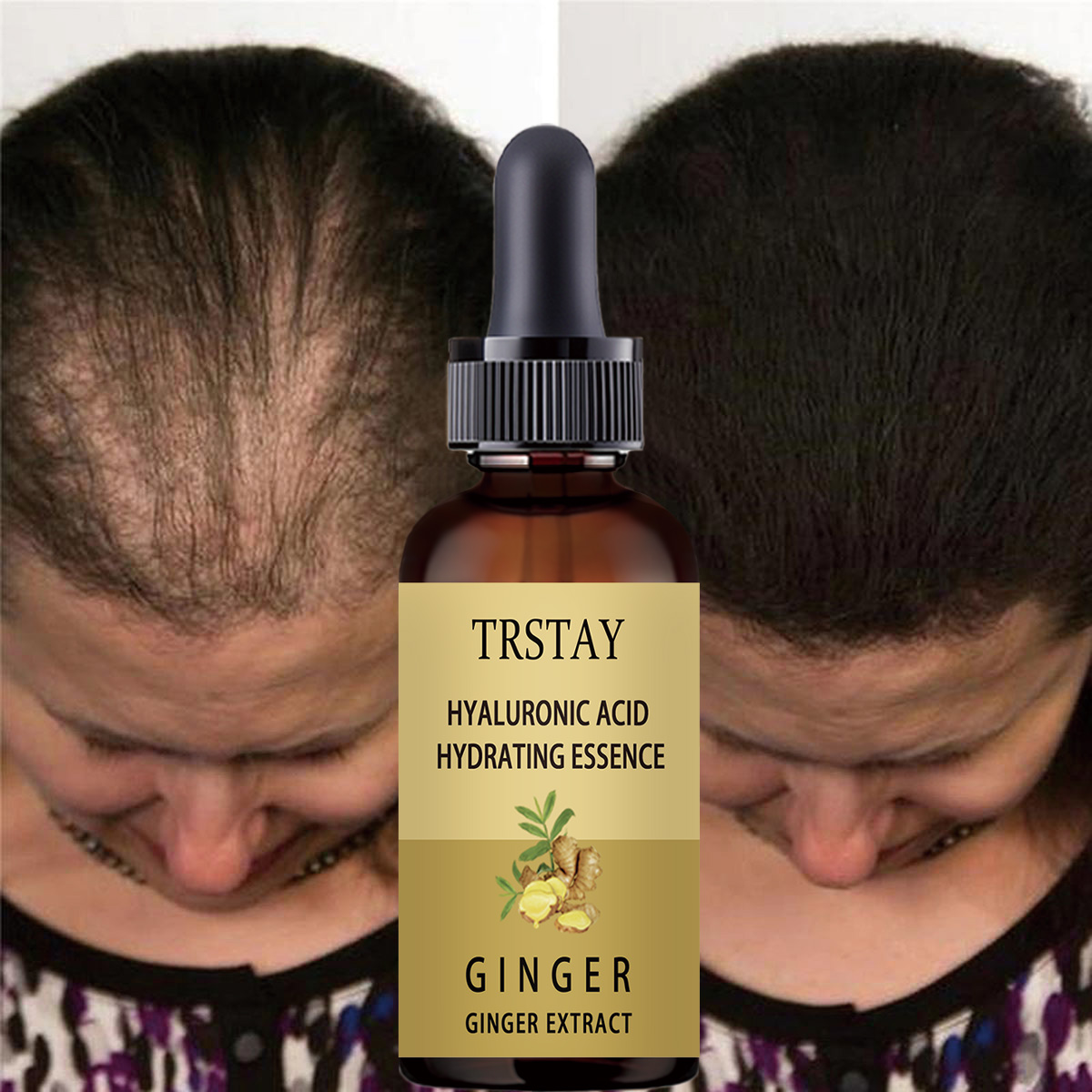 Hair Care Gisou - Soro de crescimento capilar anti-previtar a