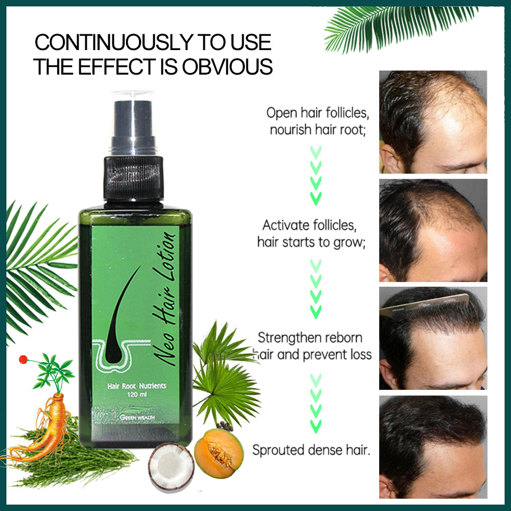 Loção capilar neo original 120 - Hair Care Gisou avaliação e preço