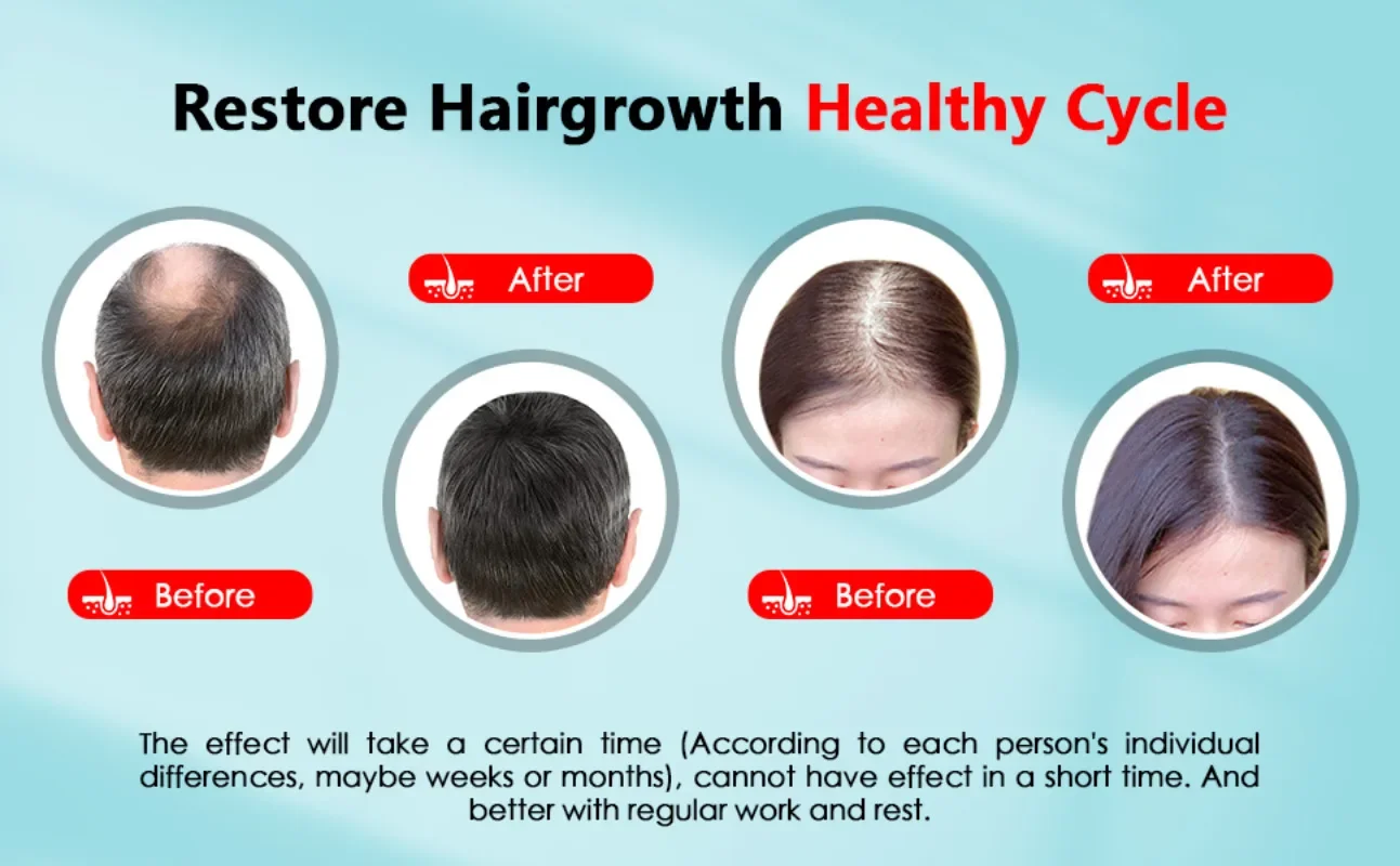 Tampa de crescimento capilar r - Hair Care Vegan avaliação e preço