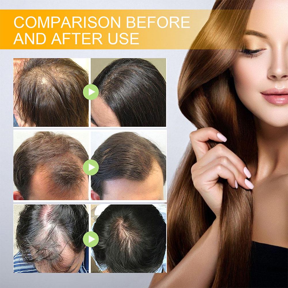 5/3/1 pçs biotina produtos de  - Hair Care Vitamin avaliação e preço